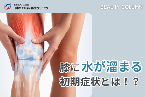 膝に水が溜まる_アイキャッチ画像