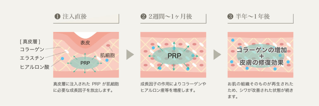 幹細胞やPRPを使った再生医療